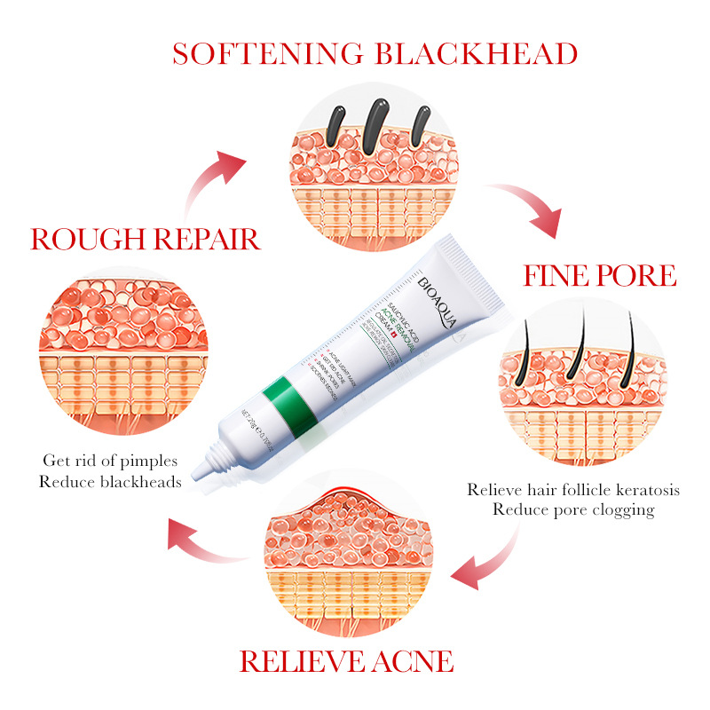 1/2/3pcs BIOAQUA Salicylic Aci - Salicylic Acid Blackhead Remover บทวิจารณ์และราคา