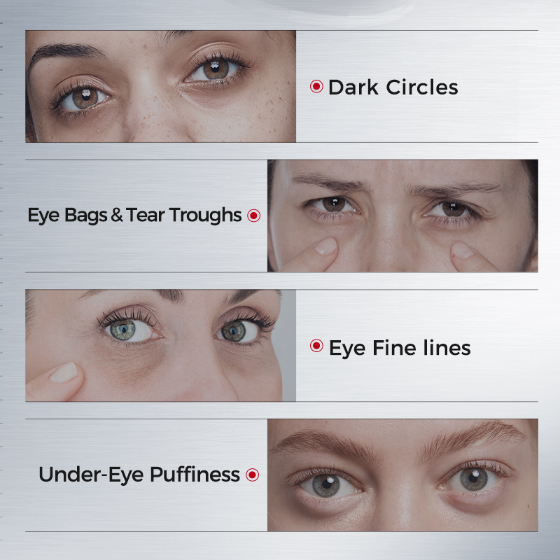 แผ่นปิดตาสำหรับรอยคล้ำใต้ตา –  - Collagen Under Eye Patches บทวิจารณ์และราคา