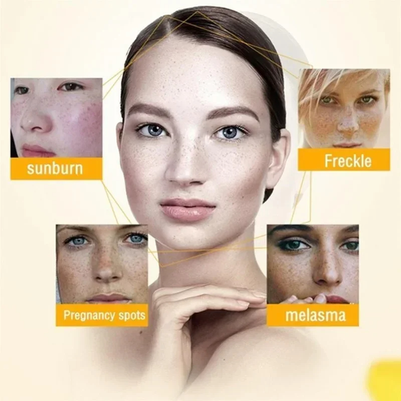 ลบริ้วรอยครีม Retinol Face Ant - Retinol Anti Wrinkle Cream บทวิจารณ์และราคา