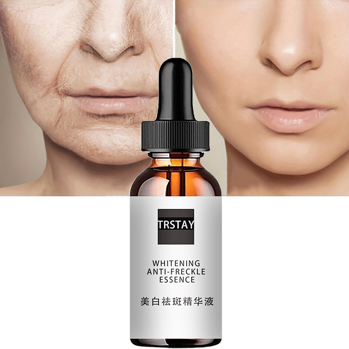 Niacinamide Acid Facial Essenc - Niacinamide Pore Shrinking Essence บทวิจารณ์และราคา