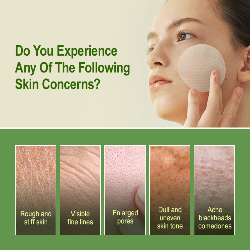 Salicylic Acid Exfoliating Pad - Salicylic Acid Blackhead Remover บทวิจารณ์และราคา