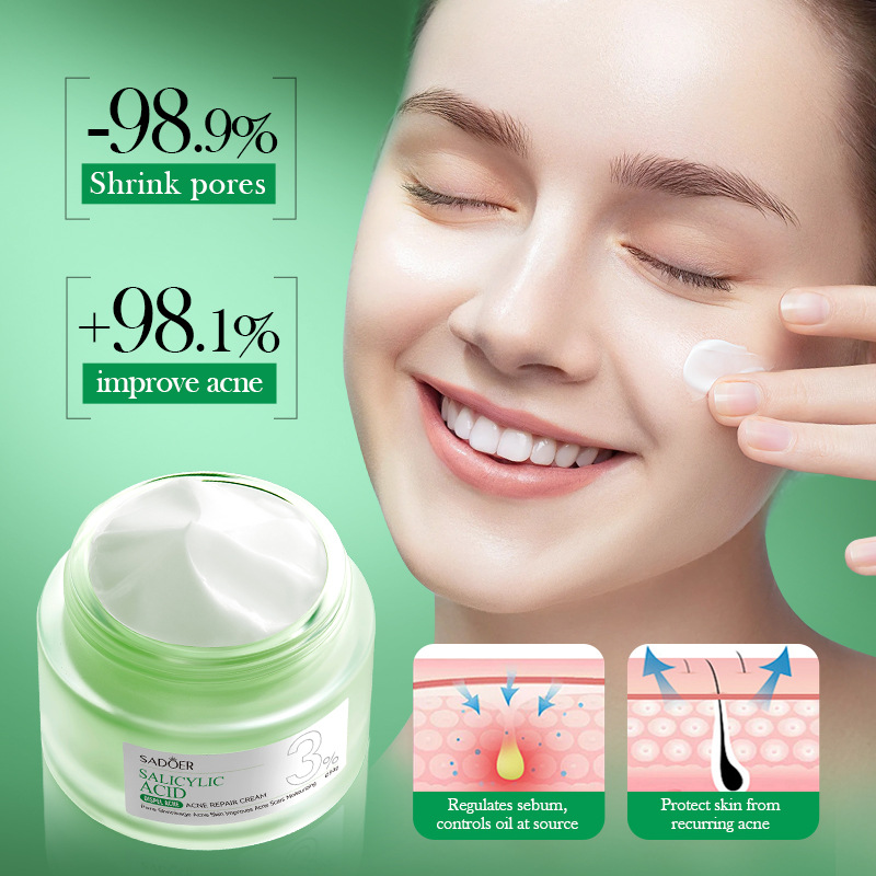 ครีมรักษาสิวกรดซาลิไซลิกซ่อมแซ - Salicylic Acid Blackhead Remover บทวิจารณ์และราคา